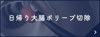 日帰り大腸ポリープ切除